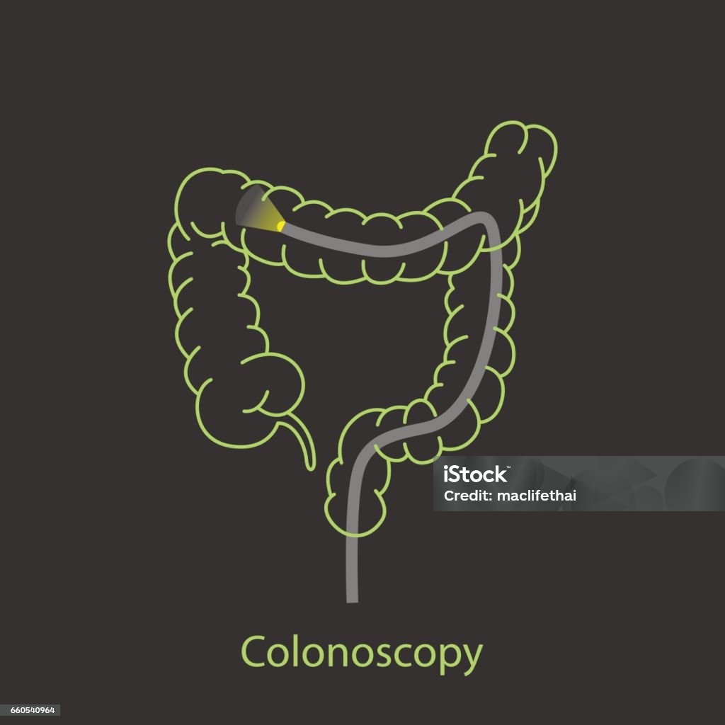 Colonoscopy