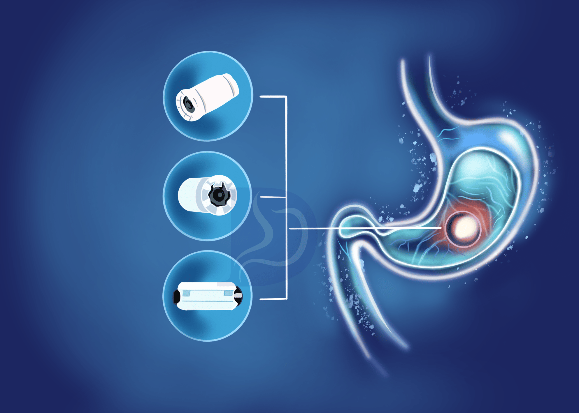 Capsule Endoscopy